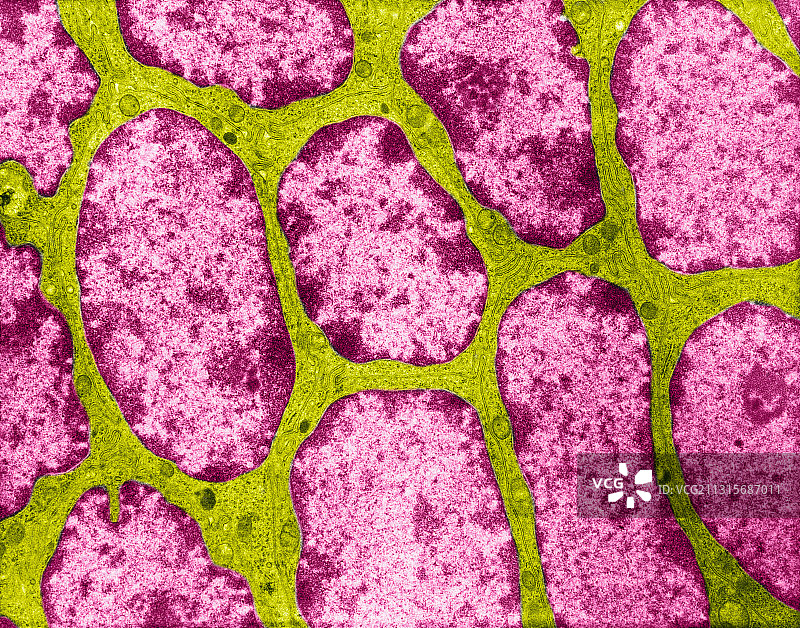 人附睾上皮细胞的透射电镜图图片素材