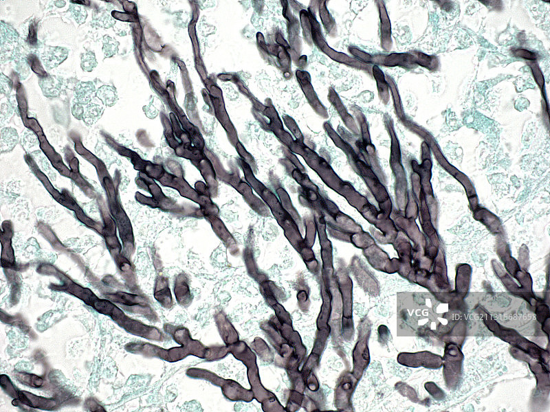 烟曲霉图片素材