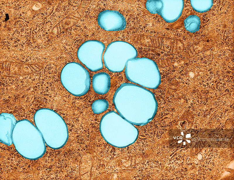 脂质细胞（透射电镜）图片素材