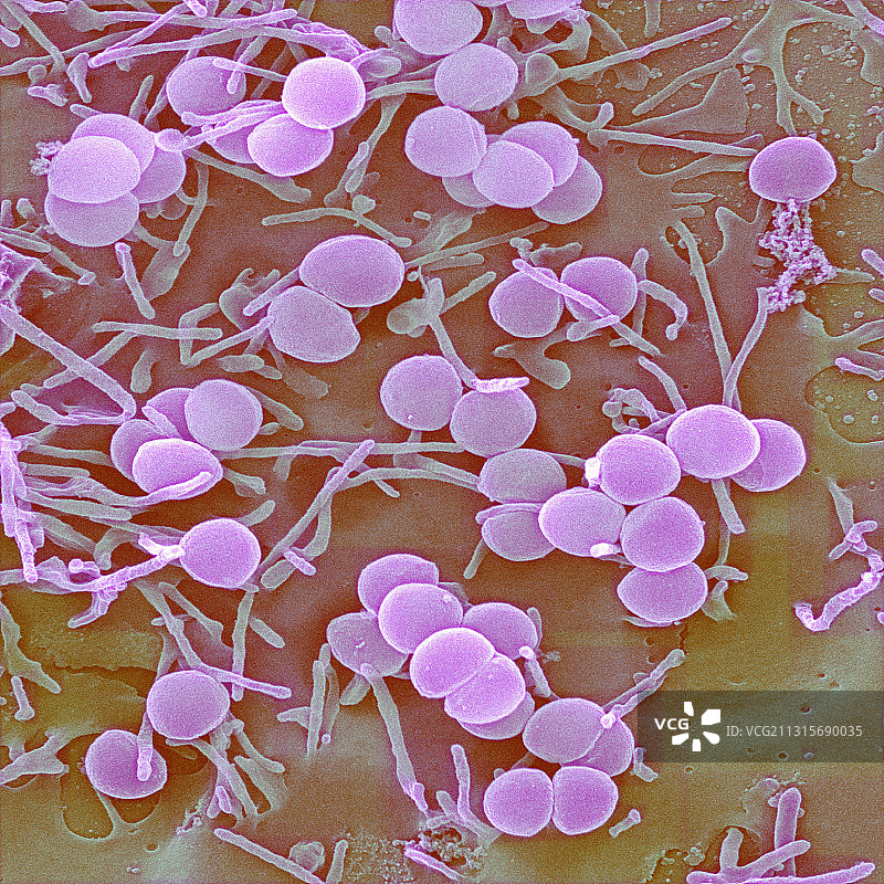 金黄色葡萄球菌图片素材