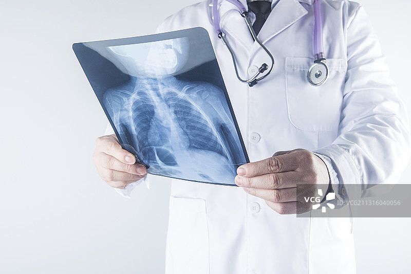 医生拿着肺部ct片图片素材
