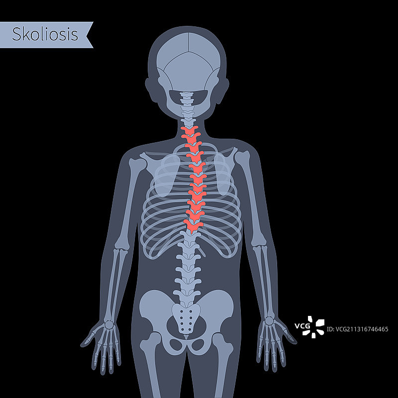 脊椎X光图片素材