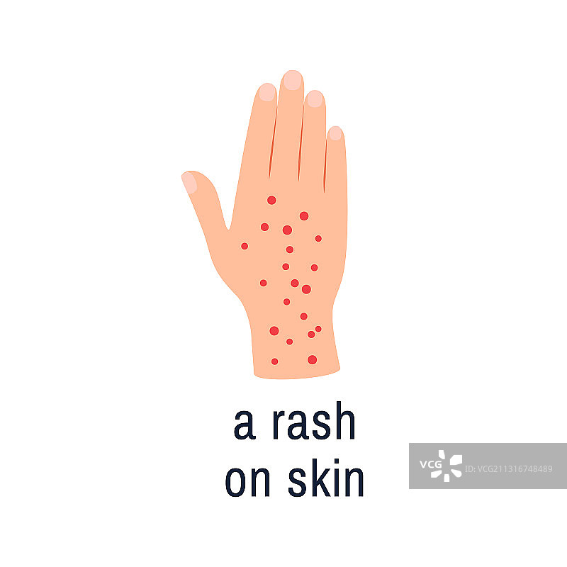 白色背景上的皮肤疹图标，过敏手掌图片素材