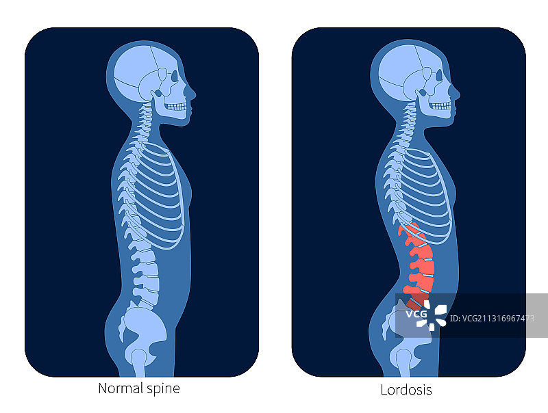 脊椎X光图片素材