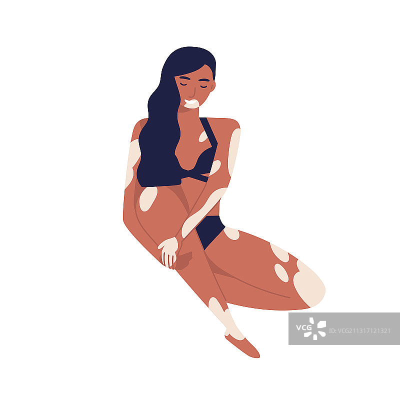 年轻的白癜风女子放松身心图片素材