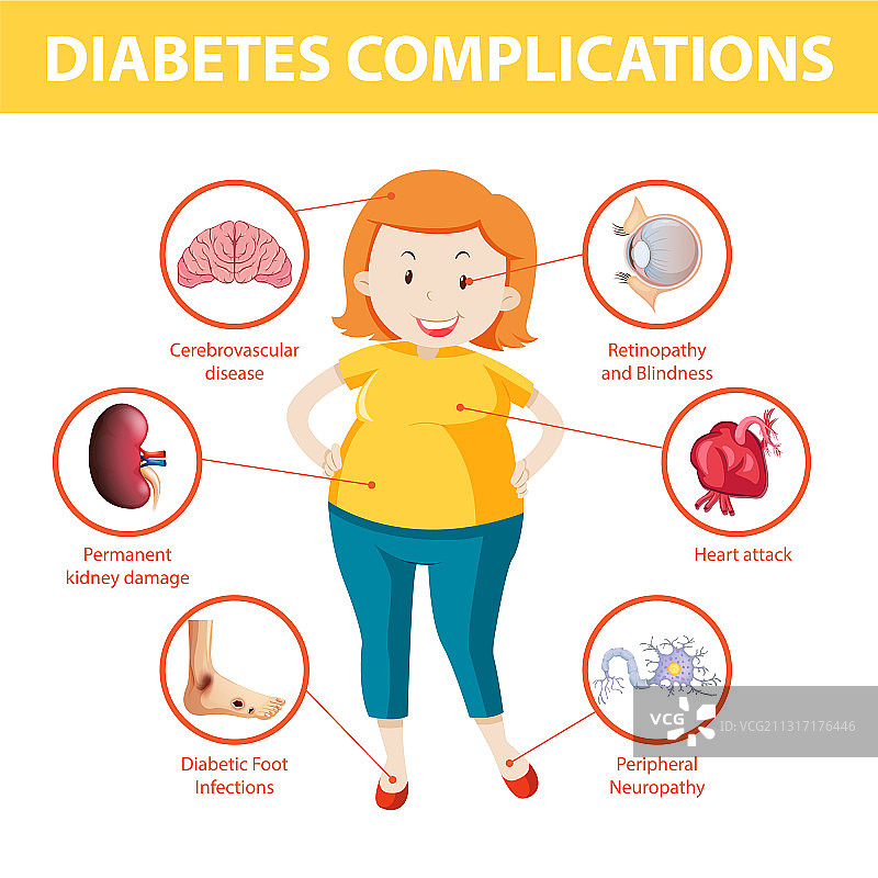 糖尿病并发症信息图图片素材