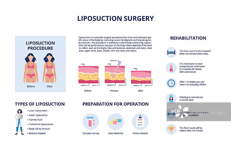 人物吸脂塑身图片素材