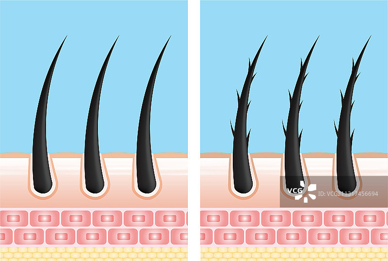 护发精华液毛囊诊断皮肤解剖图片素材