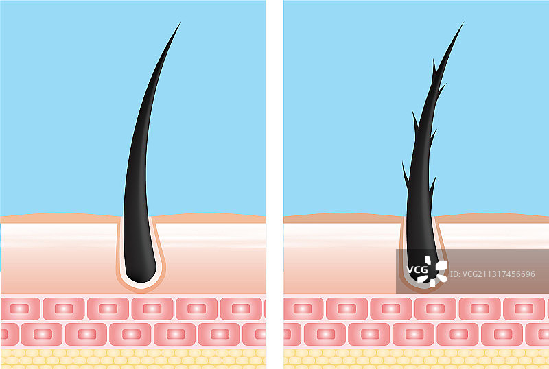护发精华液毛囊诊断皮肤解剖图片素材