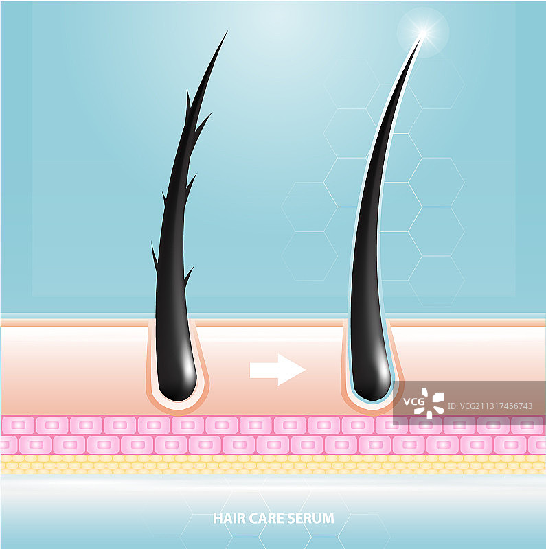 护发精华液毛囊诊断皮肤解剖图片素材