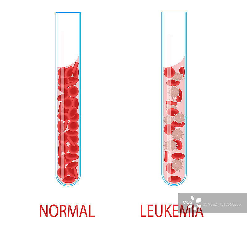 白血病图片素材