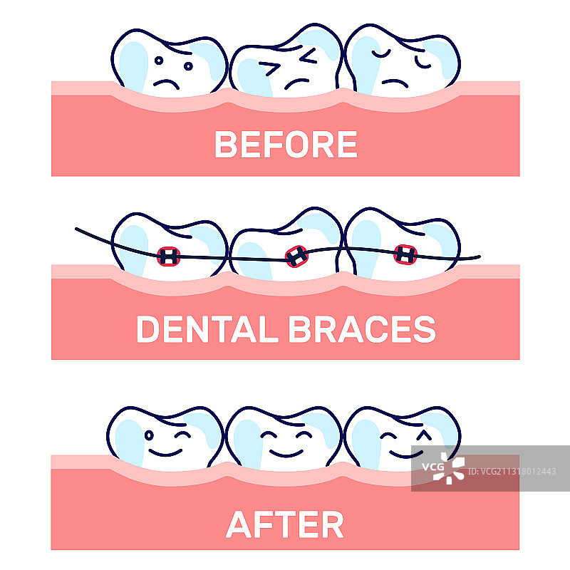 卡通可爱牙齿图片素材