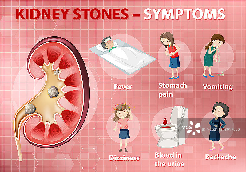 卡通风格肾结石症状信息图图片素材
