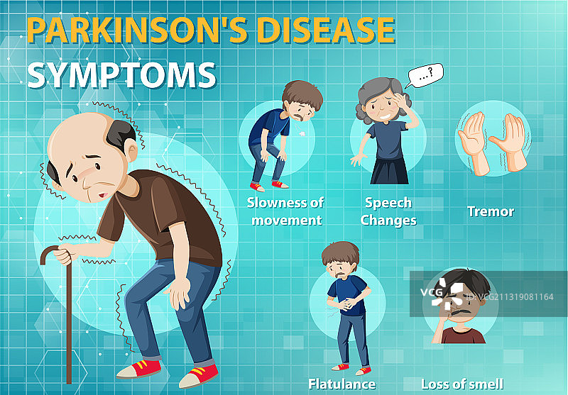 帕金森病症状信息图图片素材