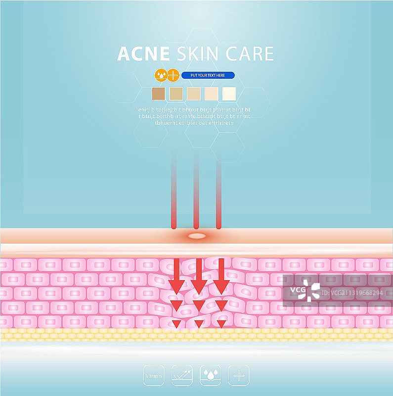痤疮皮肤斑点问题设计图片素材