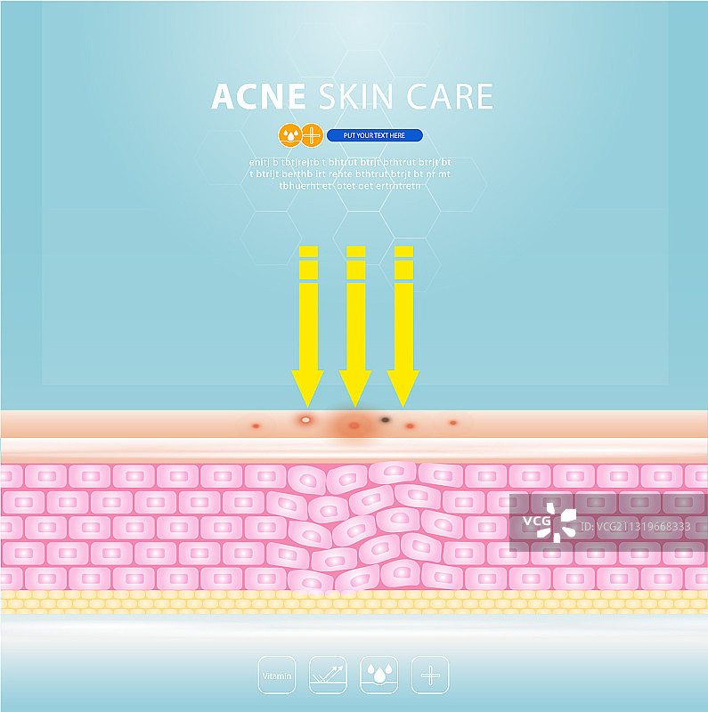 痤疮皮肤斑点问题设计图片素材