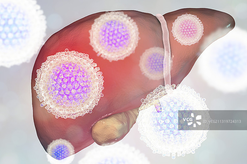感染丙型肝炎病毒的肝脏插图图片素材