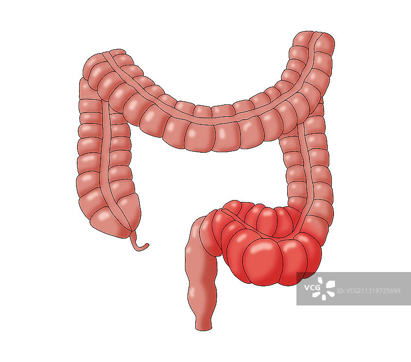 便秘的结肠插图图片素材