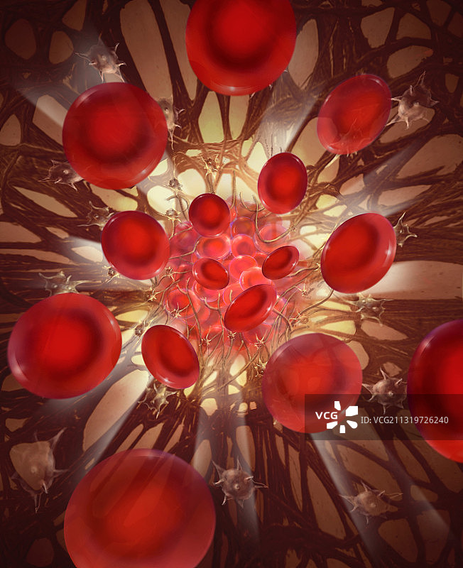 血栓破裂图片素材