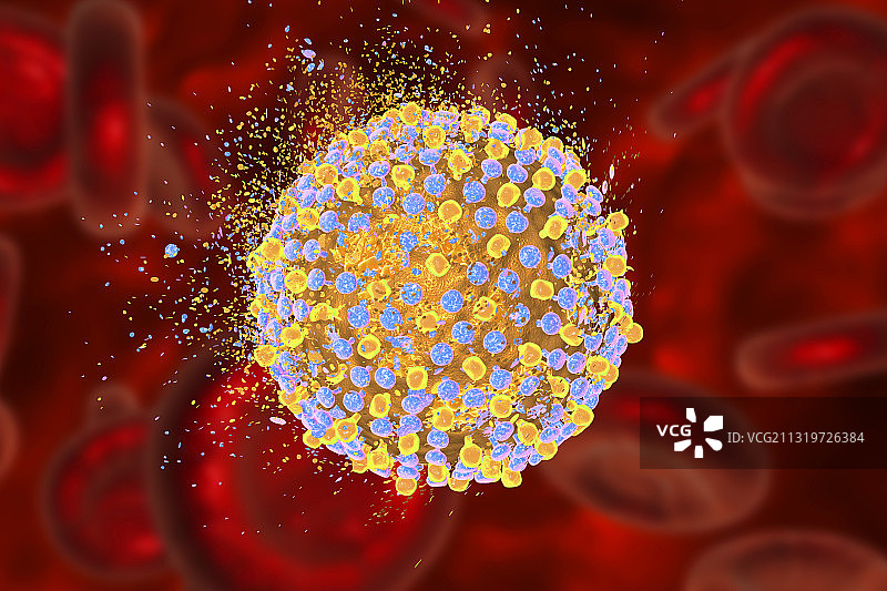 丙型肝炎病毒的破坏，图示图片素材