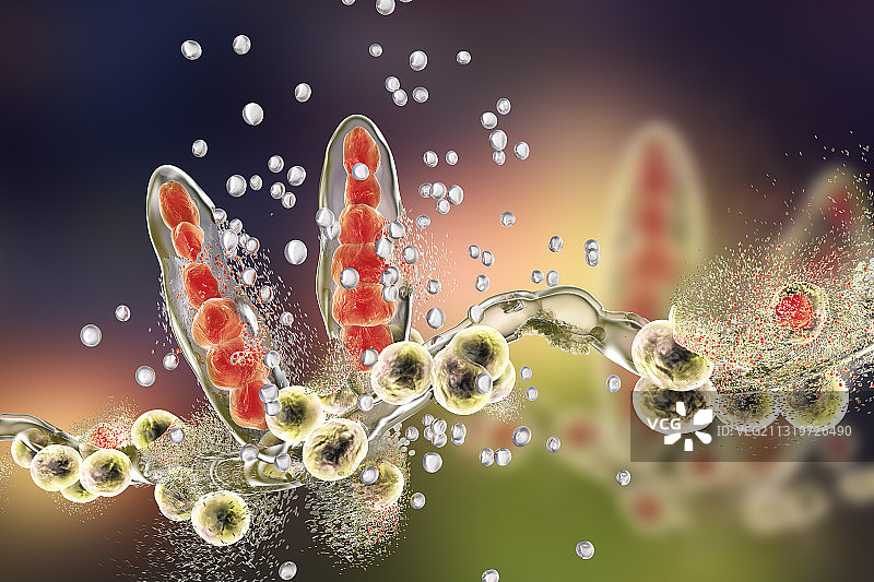 纳米粒子破坏足癣真菌的图示图片素材