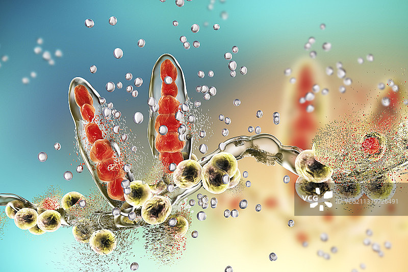 纳米粒子破坏足癣真菌的图示图片素材