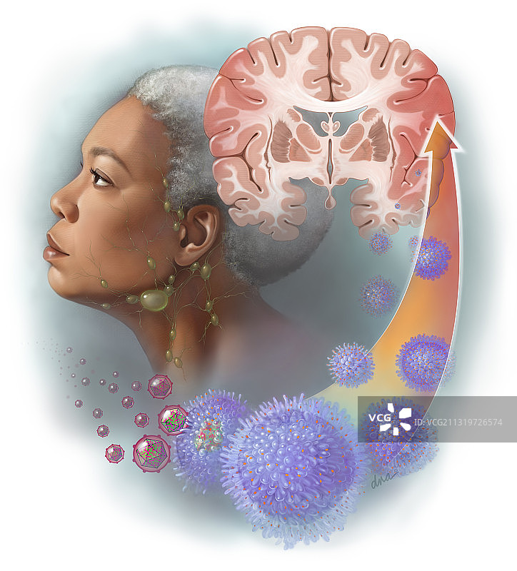 CAR T细胞疗法插图图片素材