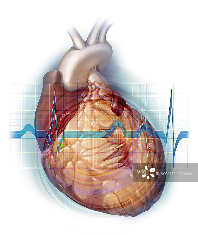 导致心室功能下降的心脏毒性，图示图片素材