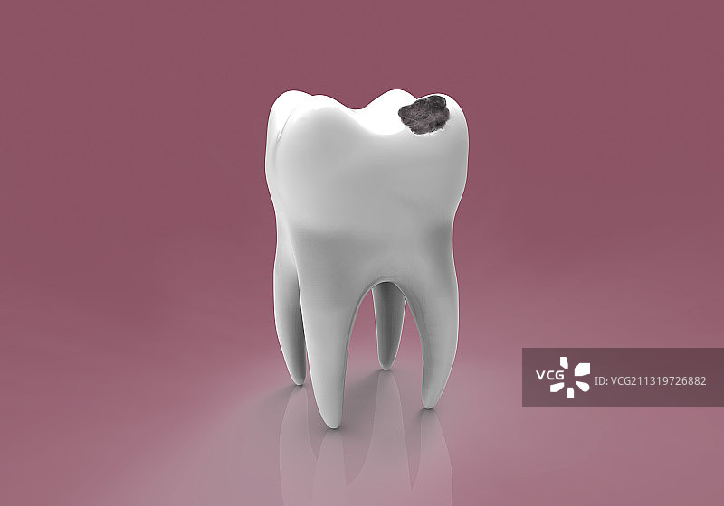 牙齿腐烂，艺术作品图片素材