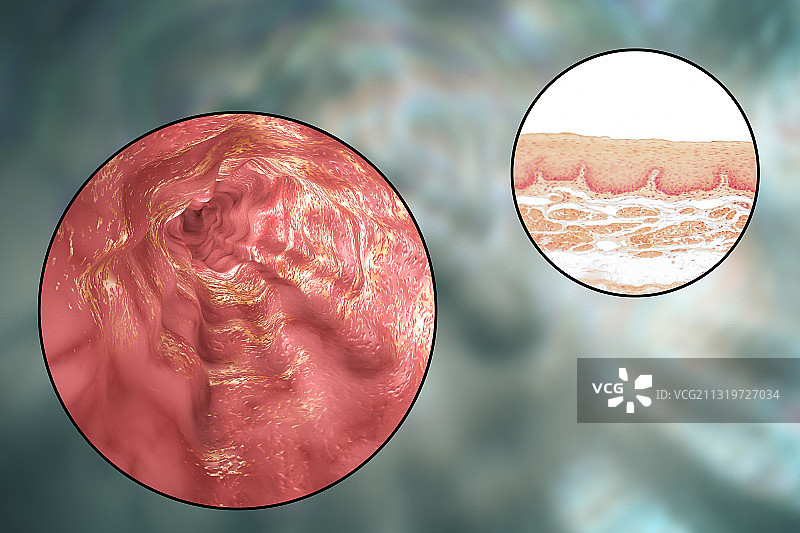 食道，光学显微照片和插图图片素材