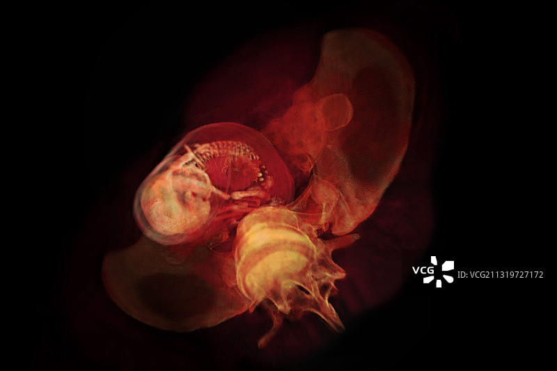 26周大的胎儿图片素材