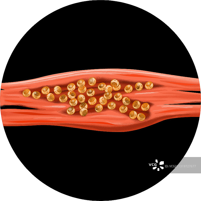 无鞭毛体图示图片素材