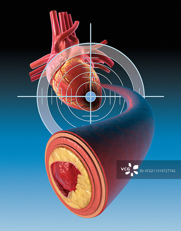 冠状动脉横截面图片素材