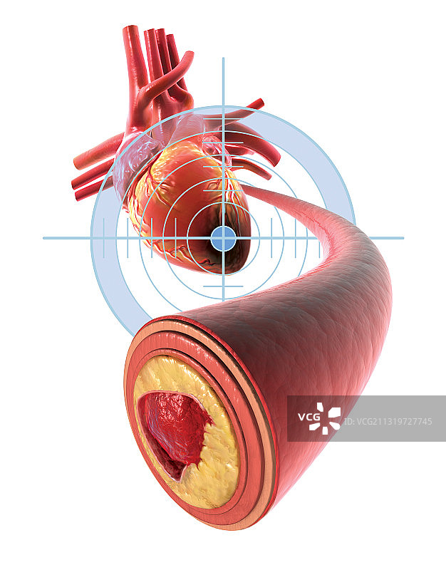 冠状动脉横截面图片素材