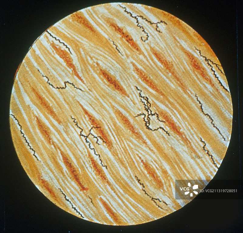 性病：梅毒螺旋体图片素材
