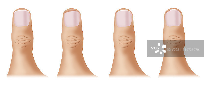 正确的指甲护理图片素材