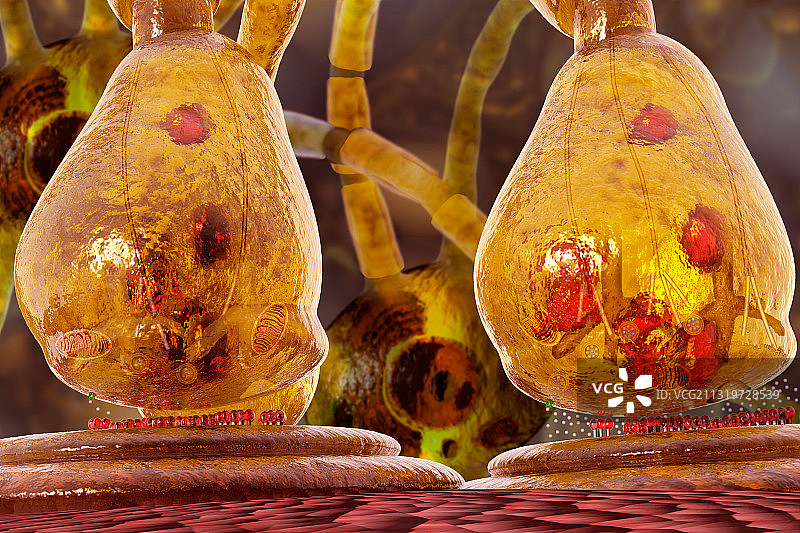 多巴胺与神经元（帕金森病）图片素材