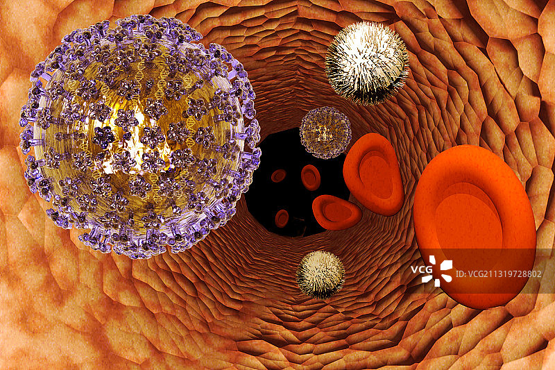 水痘-带状疱疹病毒图片素材