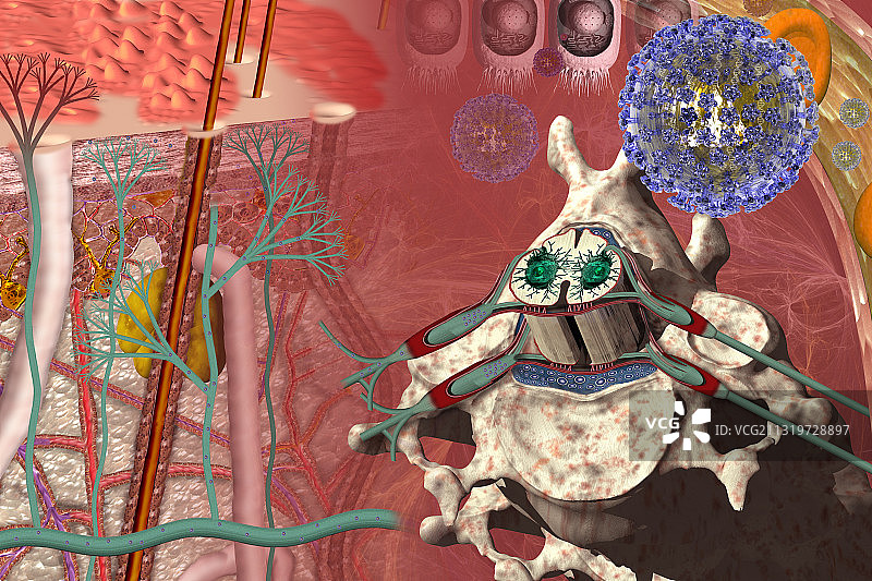 水痘-带状疱疹病毒感染阶段图片素材