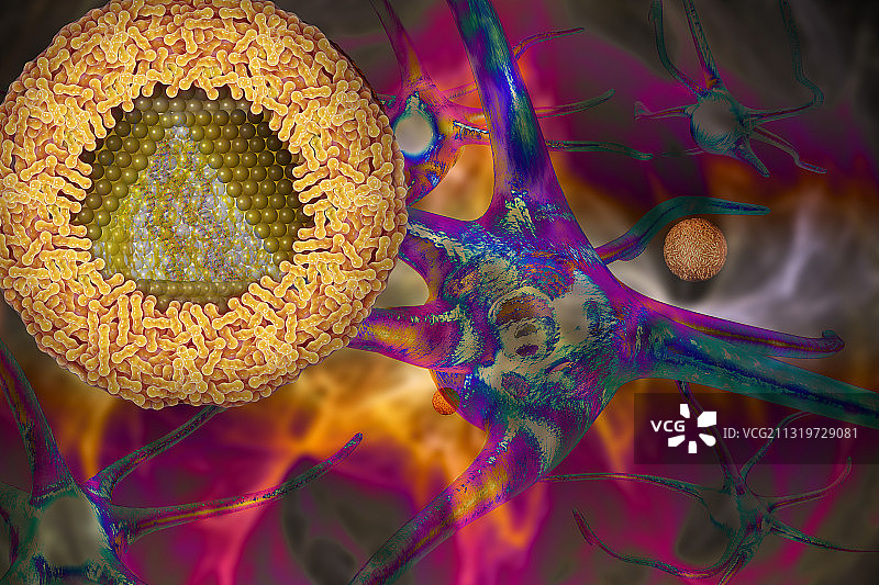 西尼罗病毒和脑炎图片素材