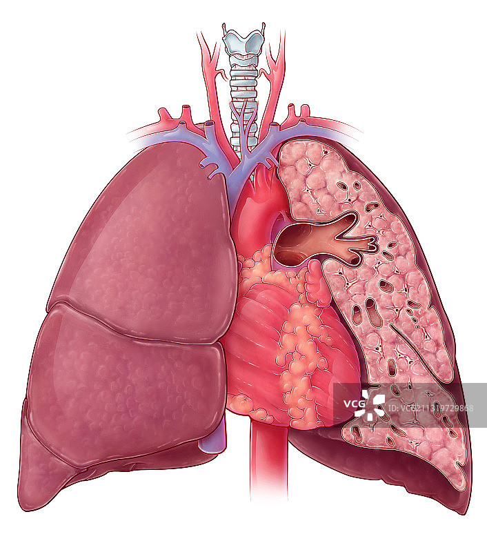 心肺解剖结构图图片素材
