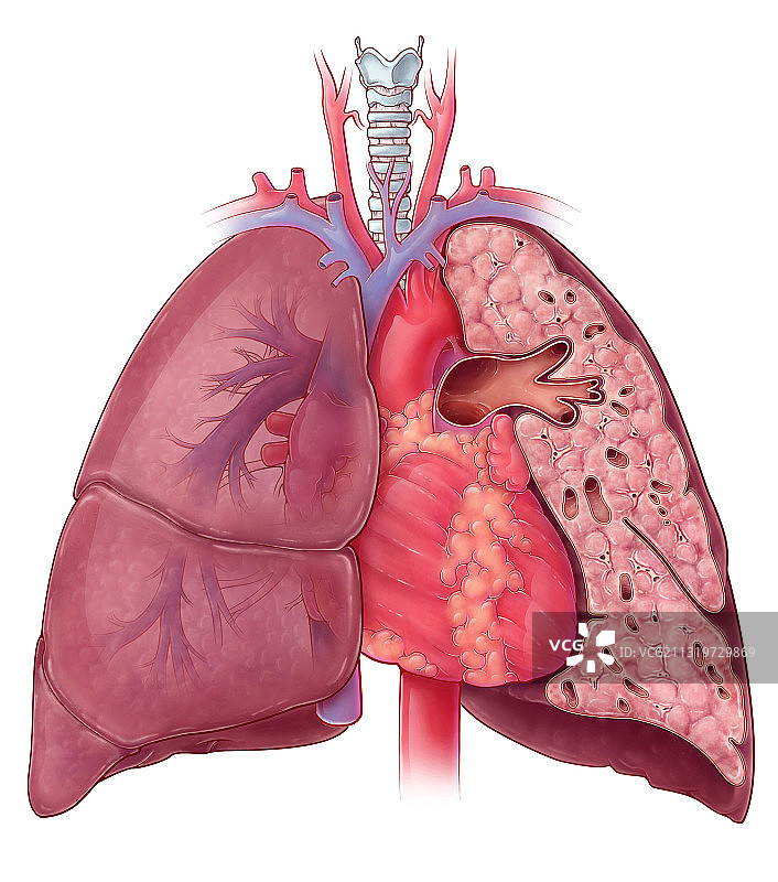 心肺解剖结构图图片素材