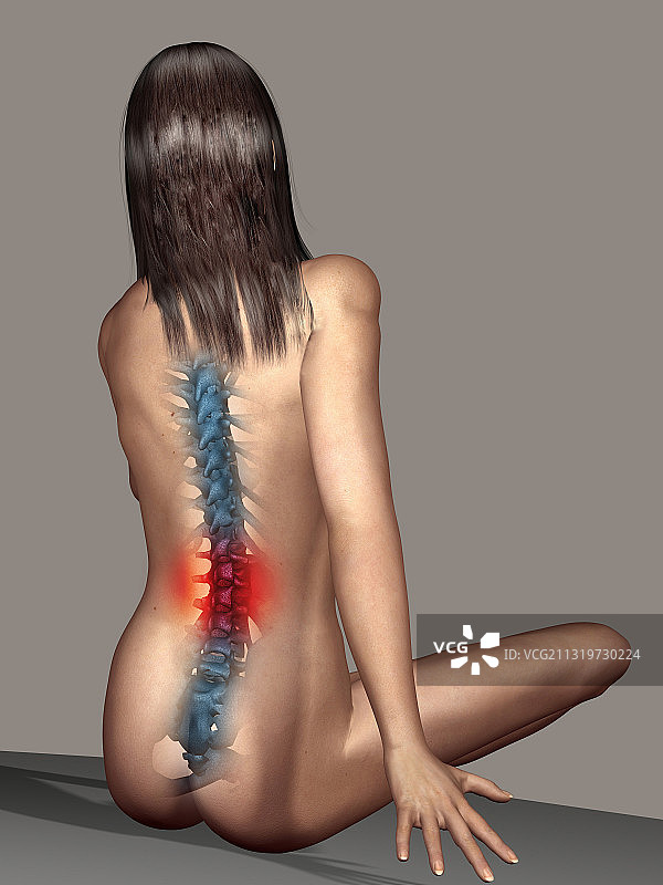 背痛女性插画图片素材