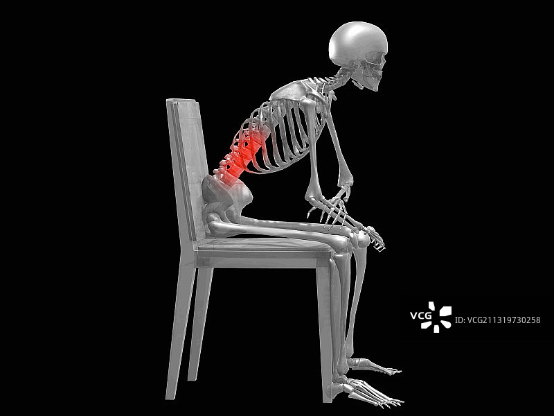 腰背部疼痛示意图图片素材