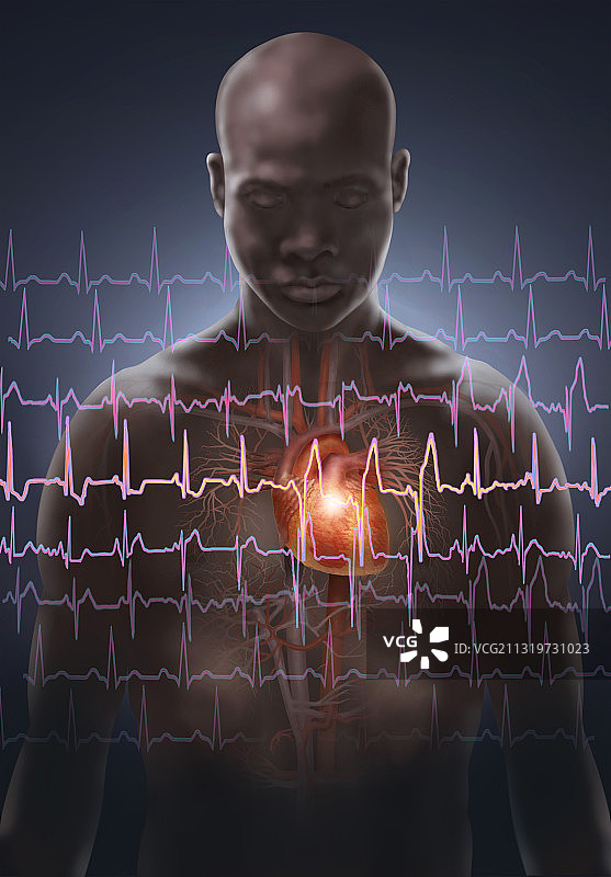 心脏病发作图片素材