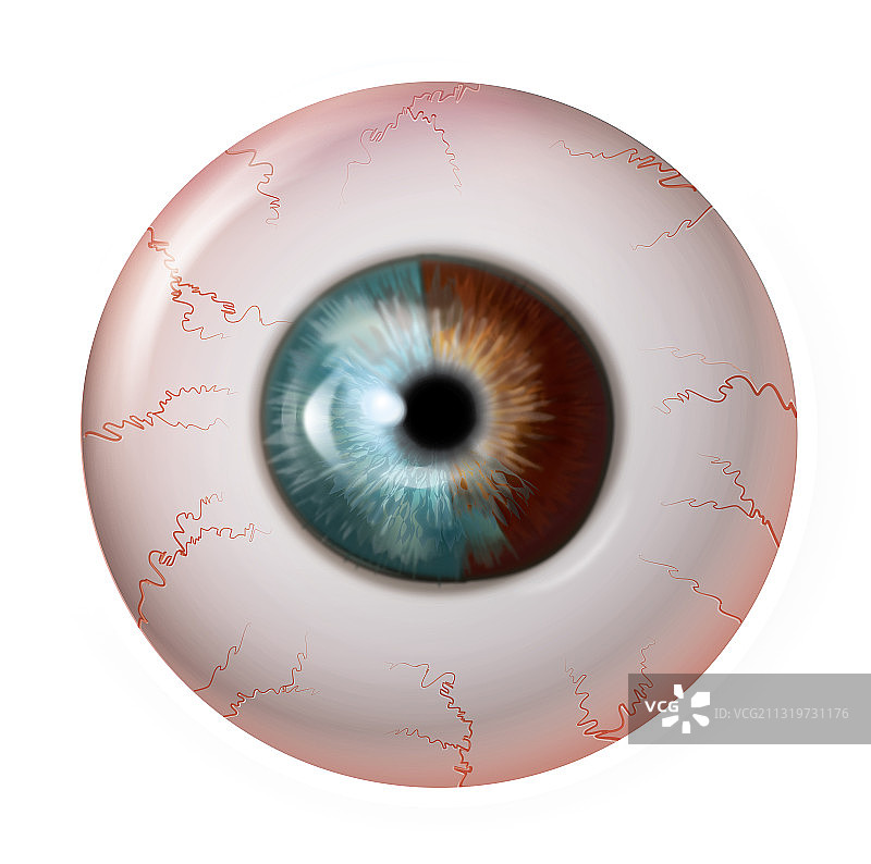 具有局部异色症的眼球图片素材