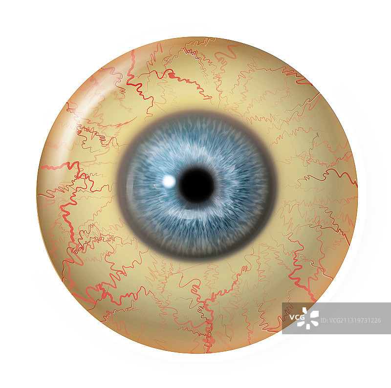 中度巩膜黄疸图片素材