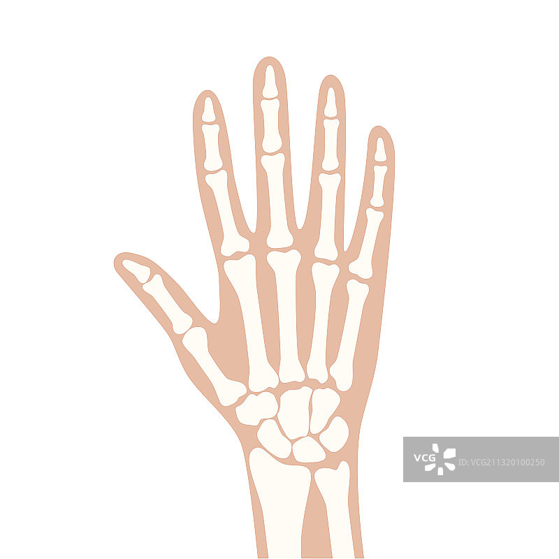 关节炎X光片图片素材