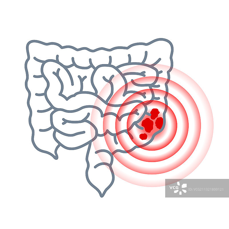 结肠癌图标——肠道和疼痛圈图片素材