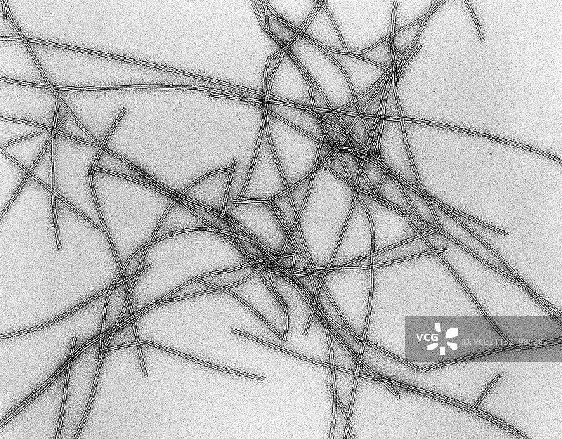 微管，透射电子显微镜图片素材